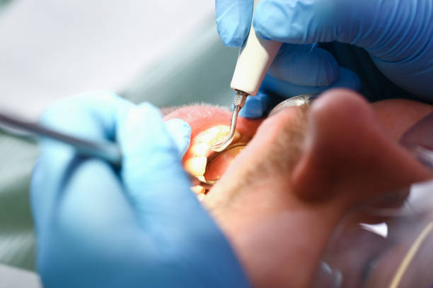 Best Cosmetic Emergency Dentistry in Brentwood, MO