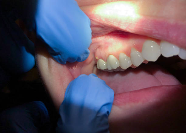 Best Pediatric Emergency Dentist in Brentwood, MO